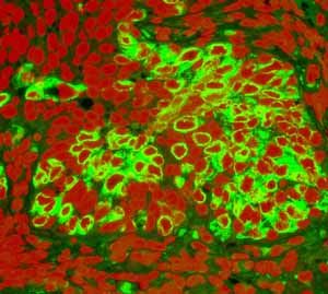 GeneTex Cytokeratin 20 antibody [EPR1622Y]