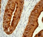 GeneTex Cytokeratin 20 antibody [EPR1622Y]