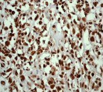 GeneTex NPM antibody [EP1848Y], N-term
