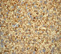 GeneTex Prion Protein (PrP) antibody [EP1802Y], C-term