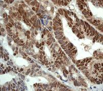 GeneTex NRF2 (phospho Ser40) antibody [EP1809Y]