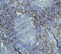 GeneTex CD8 alpha antibody [EP1150]