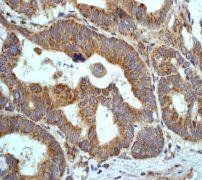 GeneTex HSF1 (phospho Ser326) antibody [EP1713Y]