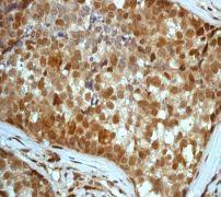 GeneTex HSF1 (phospho Ser326) antibody [EP1713Y]