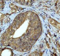 GeneTex Ubiquitin antibody [EP296Y], C-term